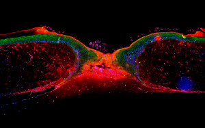 Querschnitt einer heilenden Hautwunde unter dem Mikroskop: Die mit einem roten Farbstoff markierten Hautzellen wurden von den in die Wunde einwandernden Zellen (grün) nach oben geschoben und bilden einen Schild über den nachrückenden Zellen. Bild: Hamamatsu TIGA Center, Universitätsklinikum Heidelberg