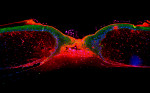 Querschnitt einer heilenden Hautwunde unter dem Mikroskop: Die mit einem roten Farbstoff markierten Hautzellen wurden von den in die Wunde einwandernden Zellen (grün) nach oben geschoben und bilden einen Schild über den nachrückenden Zellen.